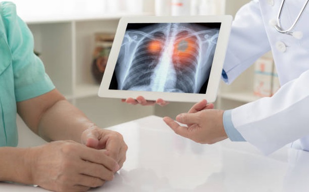 best lung cancer surgeon in vashi